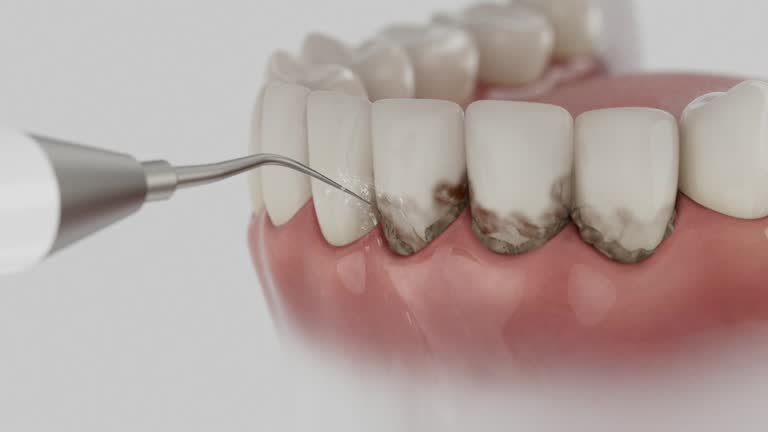 Trusted Tooth Extraction service in West Laurel, MD - Dentist Open Now